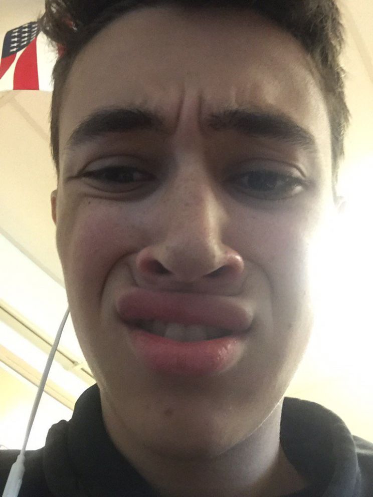 Ben Rosenblatt