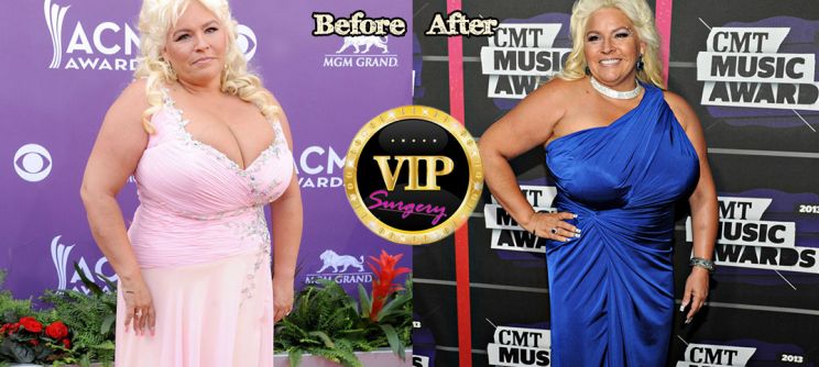 Beth Chapman