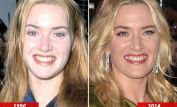 Beth Winslet