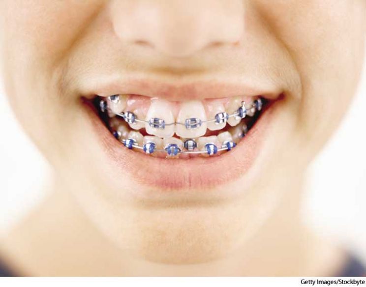 Brace