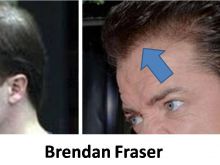 Brendan Fraser