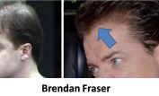 Brendan Fraser