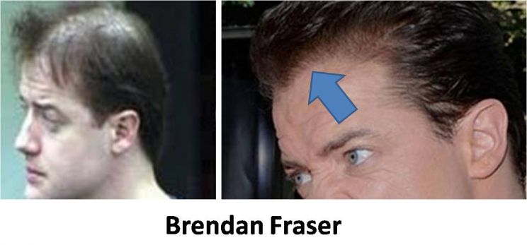 Brendan Fraser