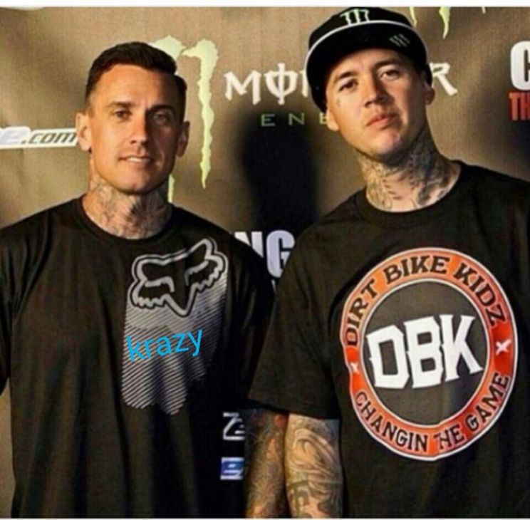 Carey Hart