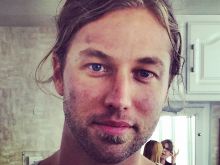 Casey James