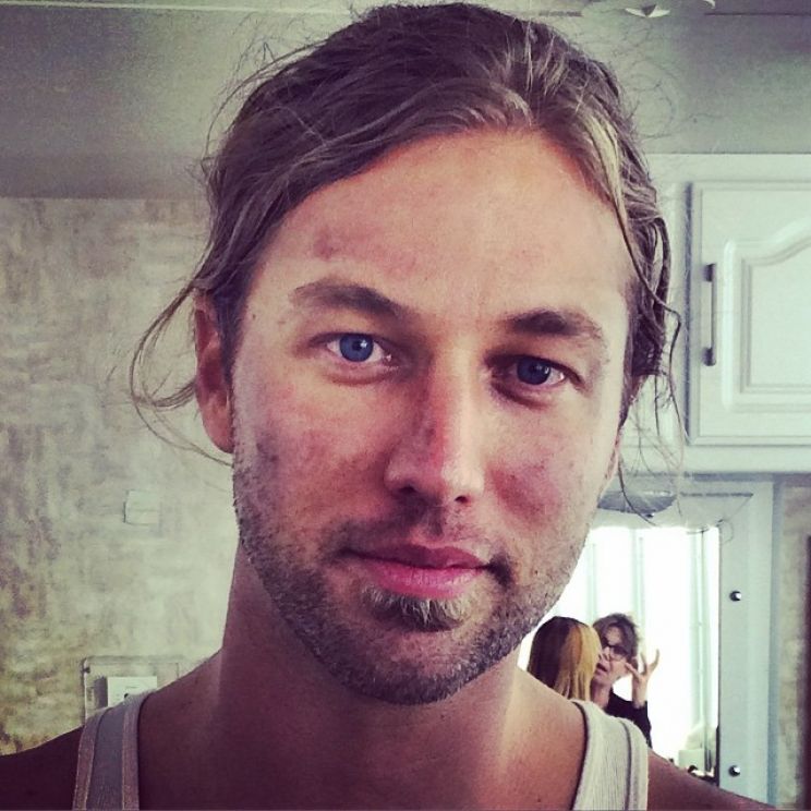 Casey James