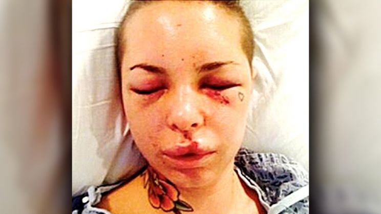 Christy Mack