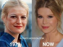 Cindy Jackson