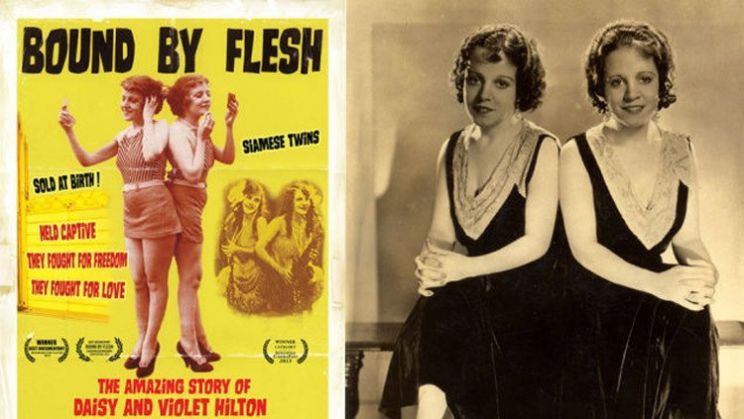 Daisy Hilton