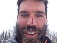 Dan Bilzerian