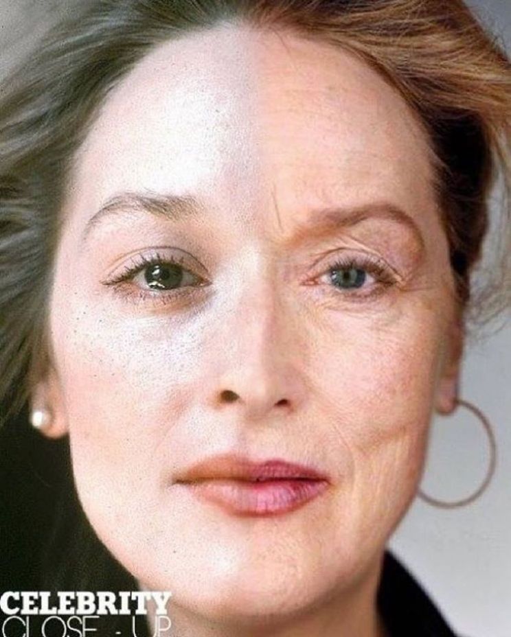 Dana Streep