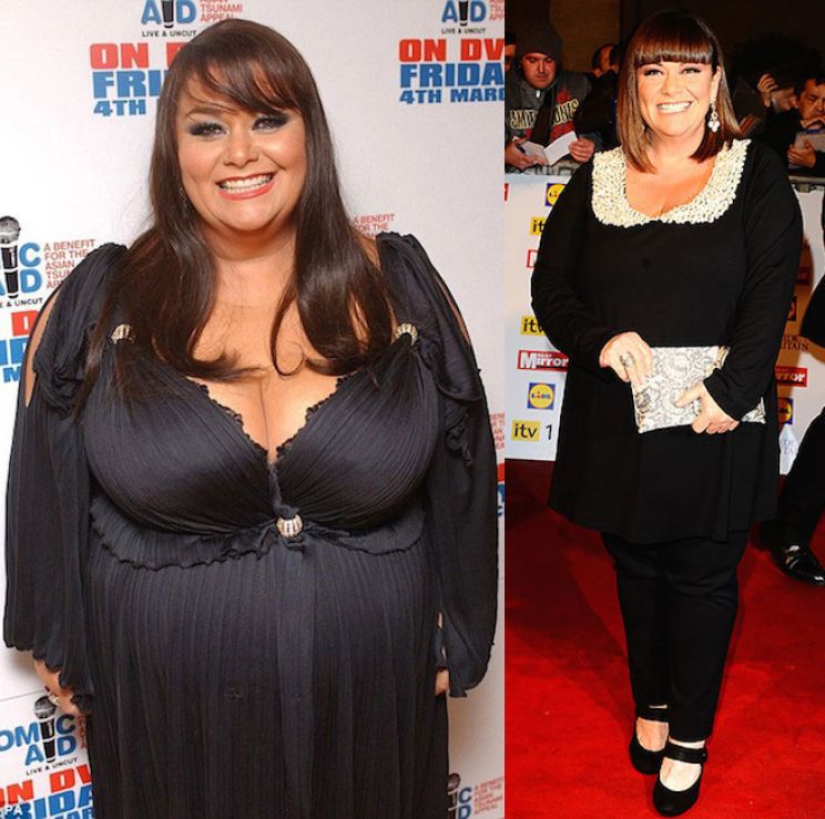Dawn French