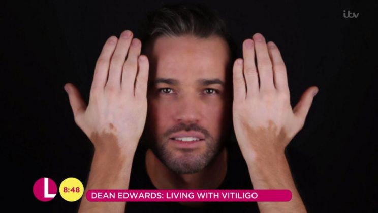 Dean Edwards