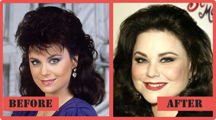 Delta Burke