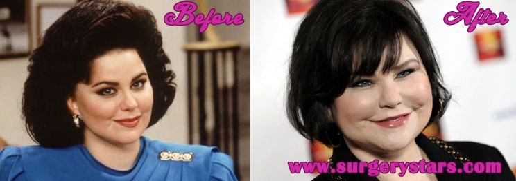 Delta Burke