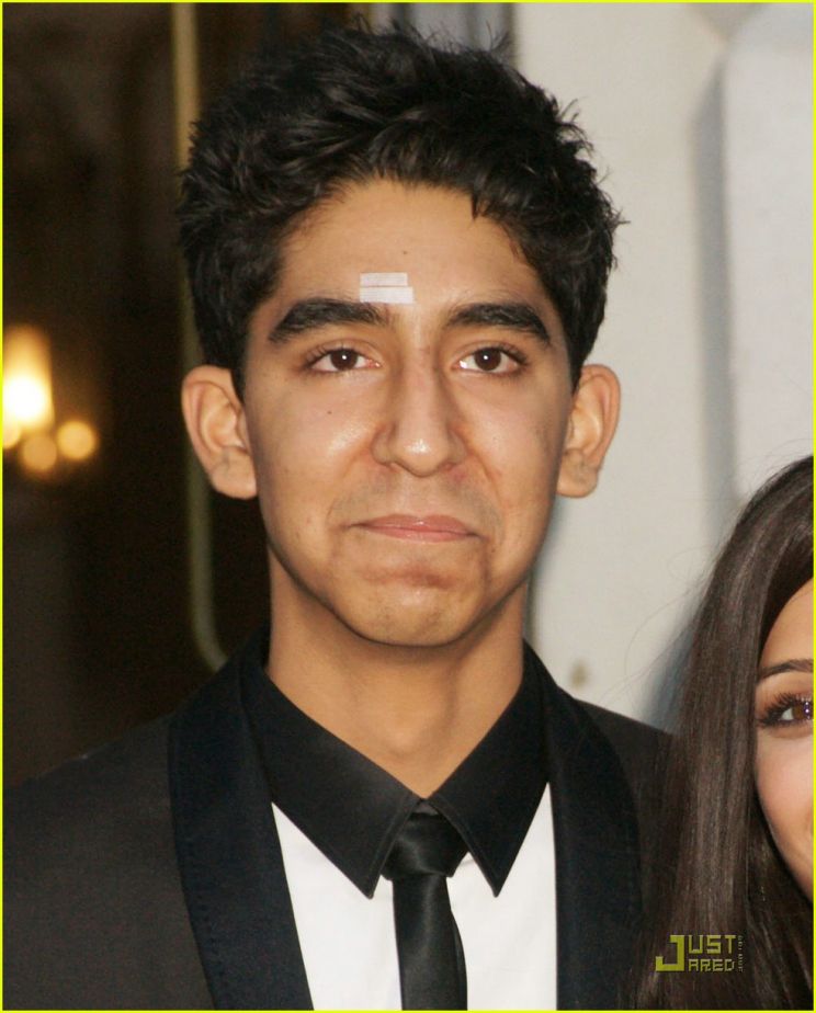 Dev Patel