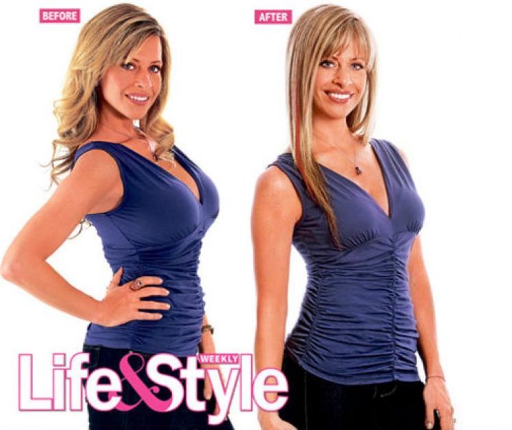 Dina Manzo