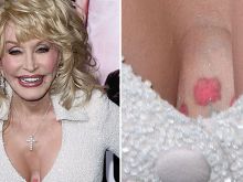 Dolly Parton