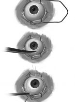Elizabeth Friedman photo