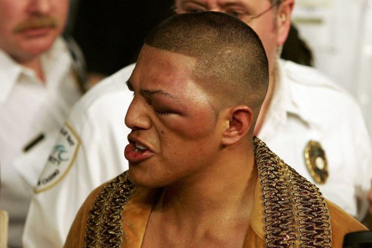 Fernando Vargas