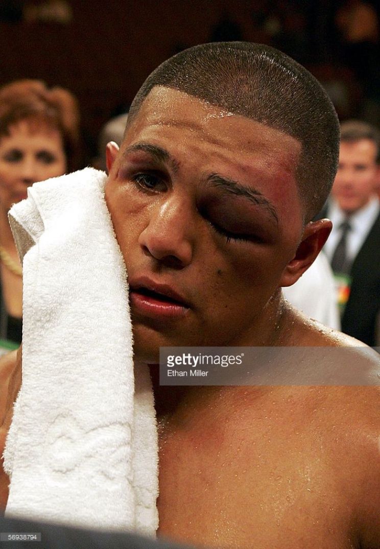 Fernando Vargas