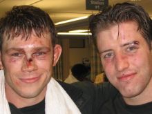 Forrest Griffin