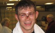 Forrest Griffin