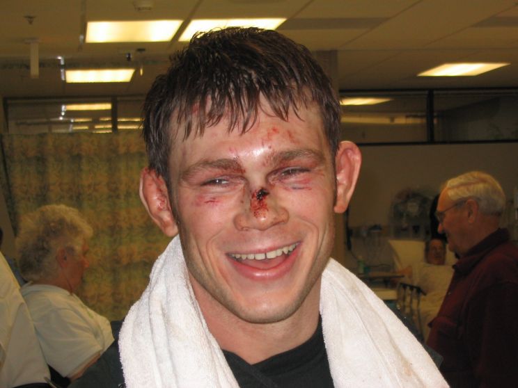 Forrest Griffin