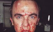 Frankie Muniz