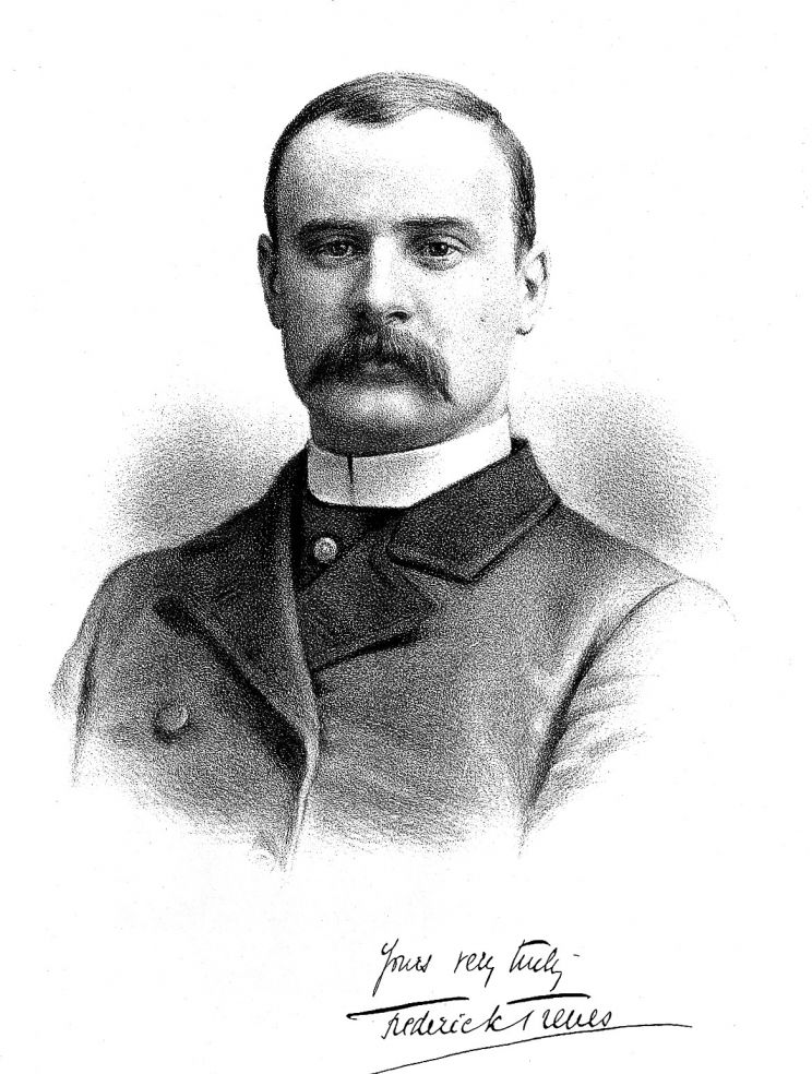 Frederick Treves