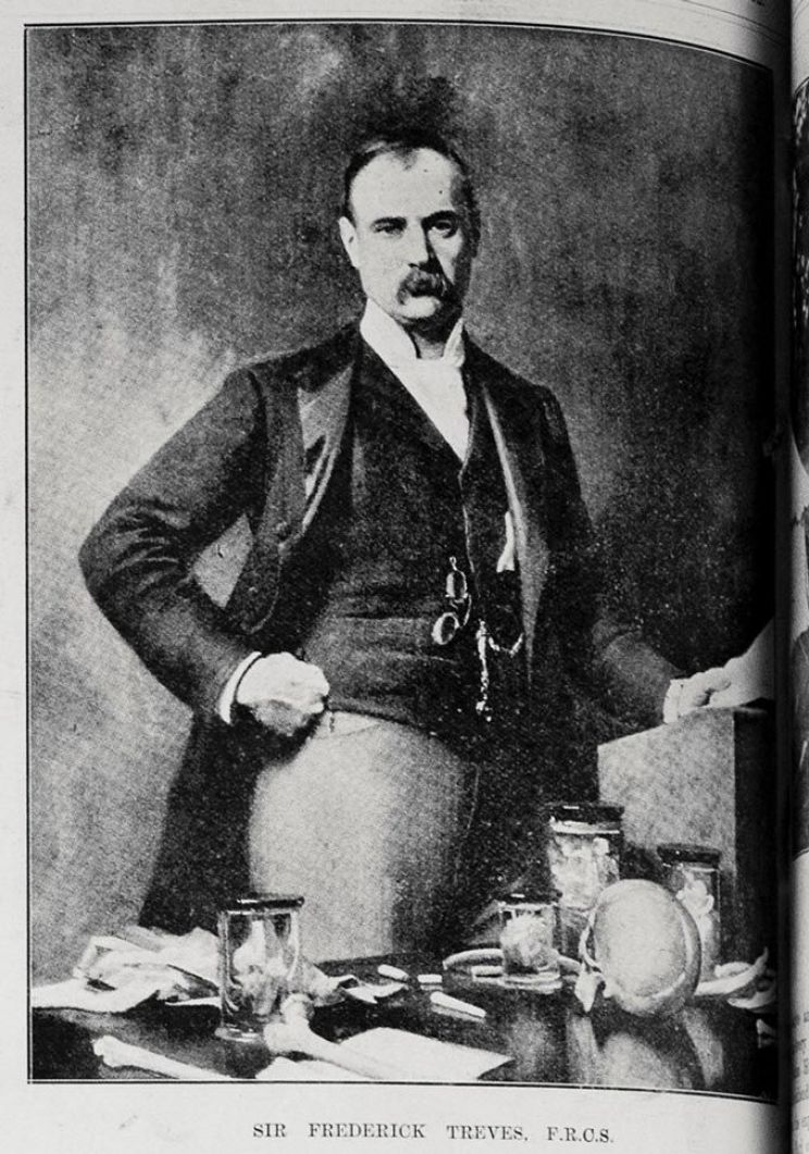 Frederick Treves