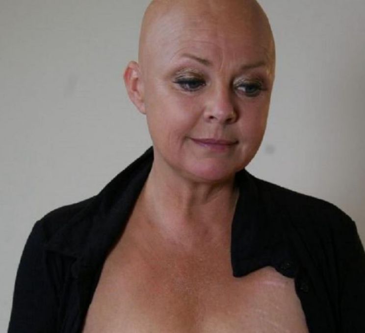 Gail Porter