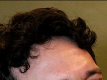 Jake Epstein
