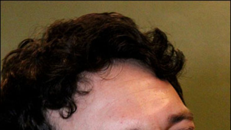 Jake Epstein