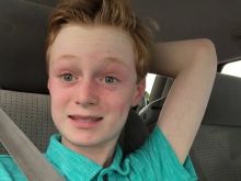 Jake Lipman
