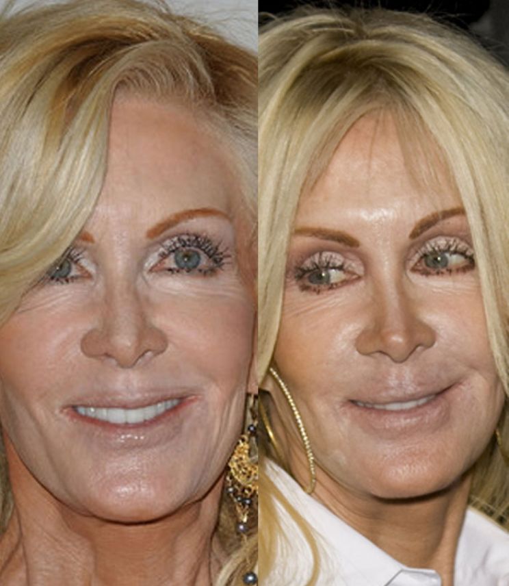 Joan Van Ark