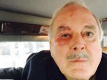 John Cleese