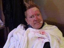 John Lydon