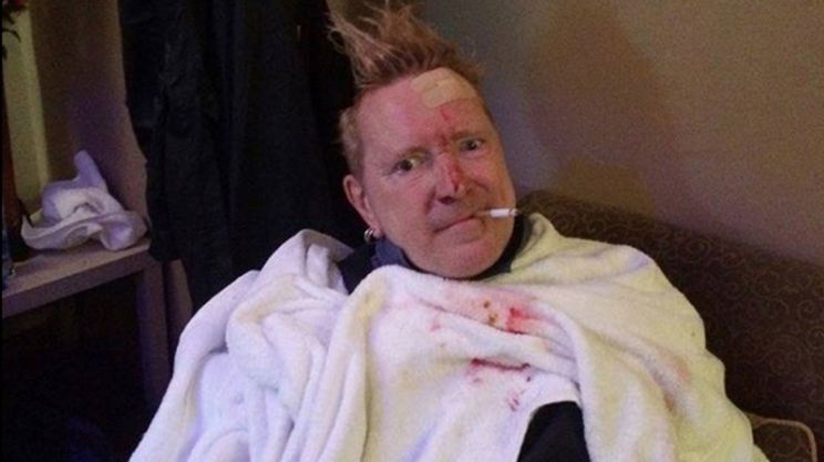 John Lydon