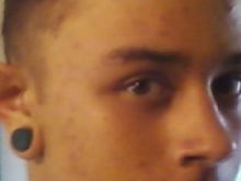 Johnny Alicea