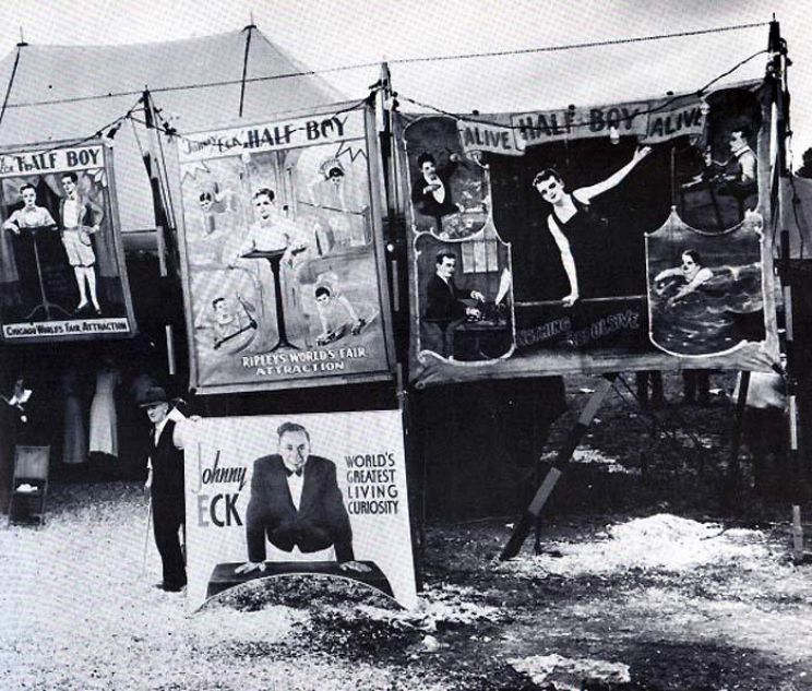 Johnny Eck