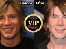 Johnny Rzeznik