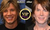 Johnny Rzeznik