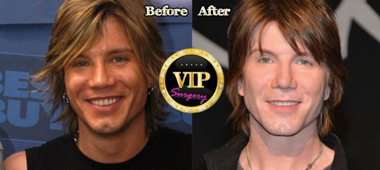 Johnny Rzeznik