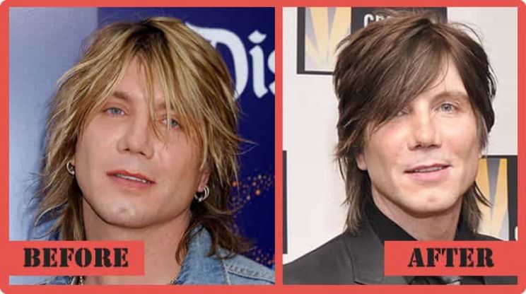Johnny Rzeznik