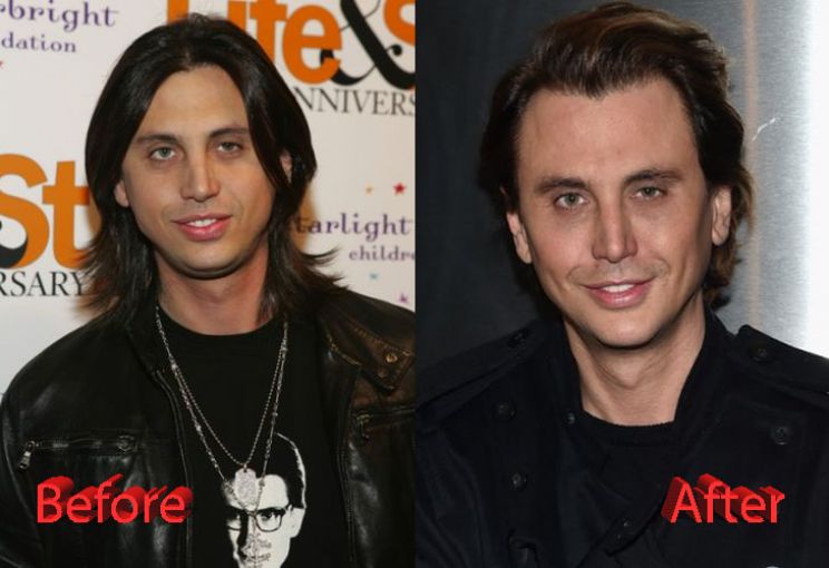 Jonathan Cheban