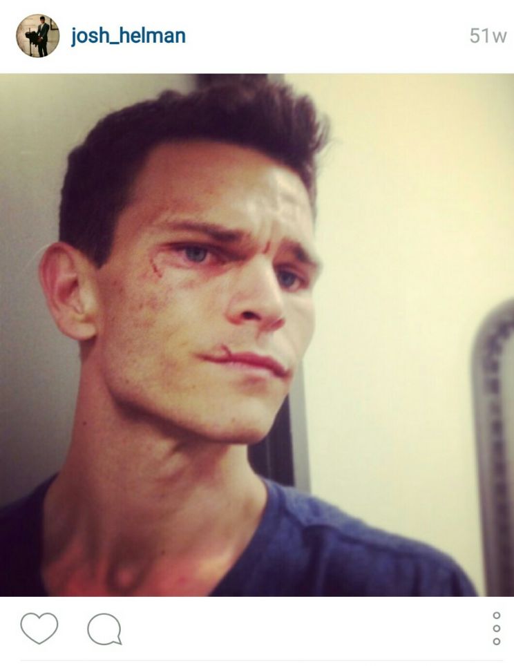 Josh Helman