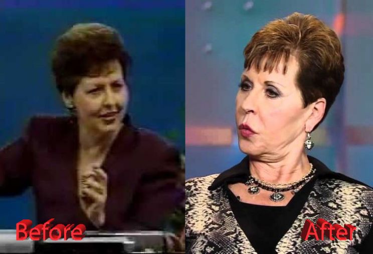 Joyce Meyer