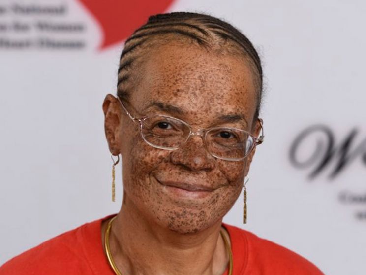 June Watson