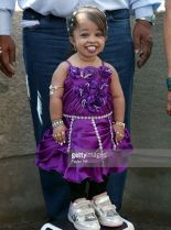 Jyoti Amge